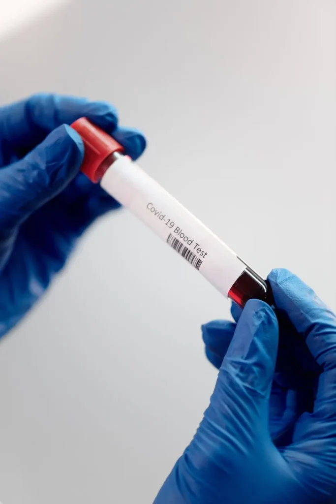 Hiv: desinformação ainda mata e afasta testes