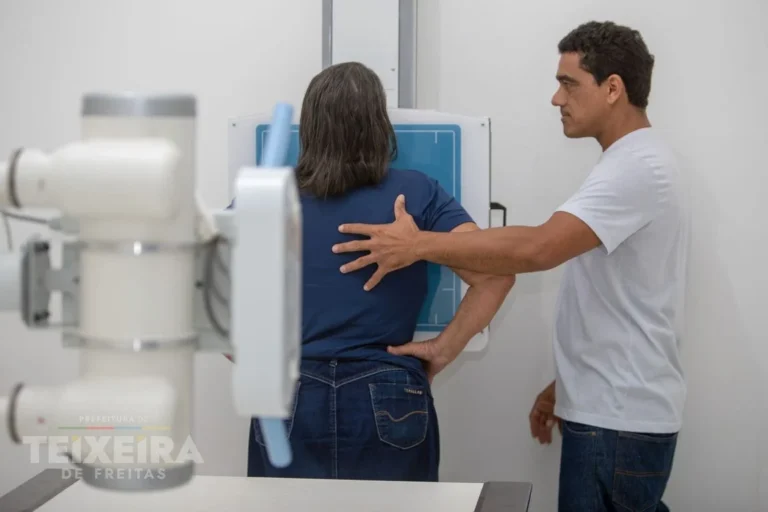 Mutirão de raio-X realiza 167 exames ortopédicos em Teixeira de Freitas